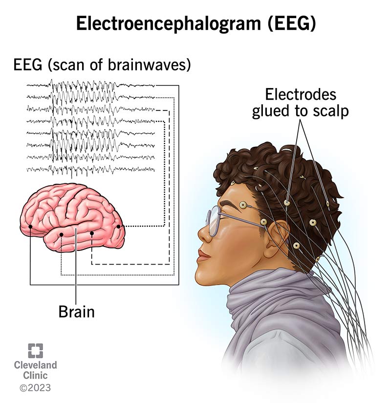EEG Image