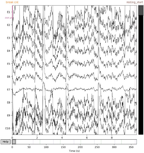 Resting State EEG